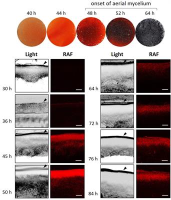 Production of Prodiginines Is Part of a Programmed Cell Death Process in Streptomyces coelicolor